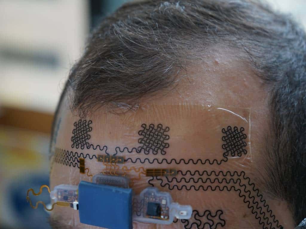 Como uma tatuagem eletrônica pode ajudar a prevenir o burnout